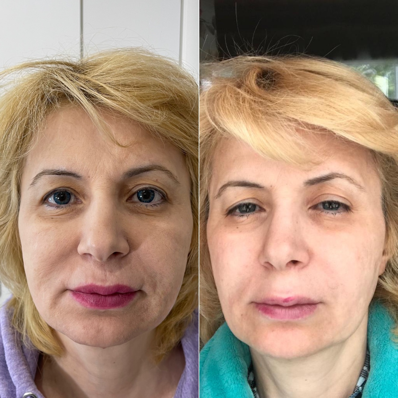 Фото работы